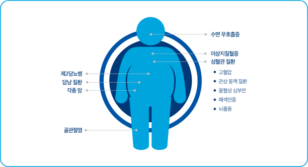 삭센다5